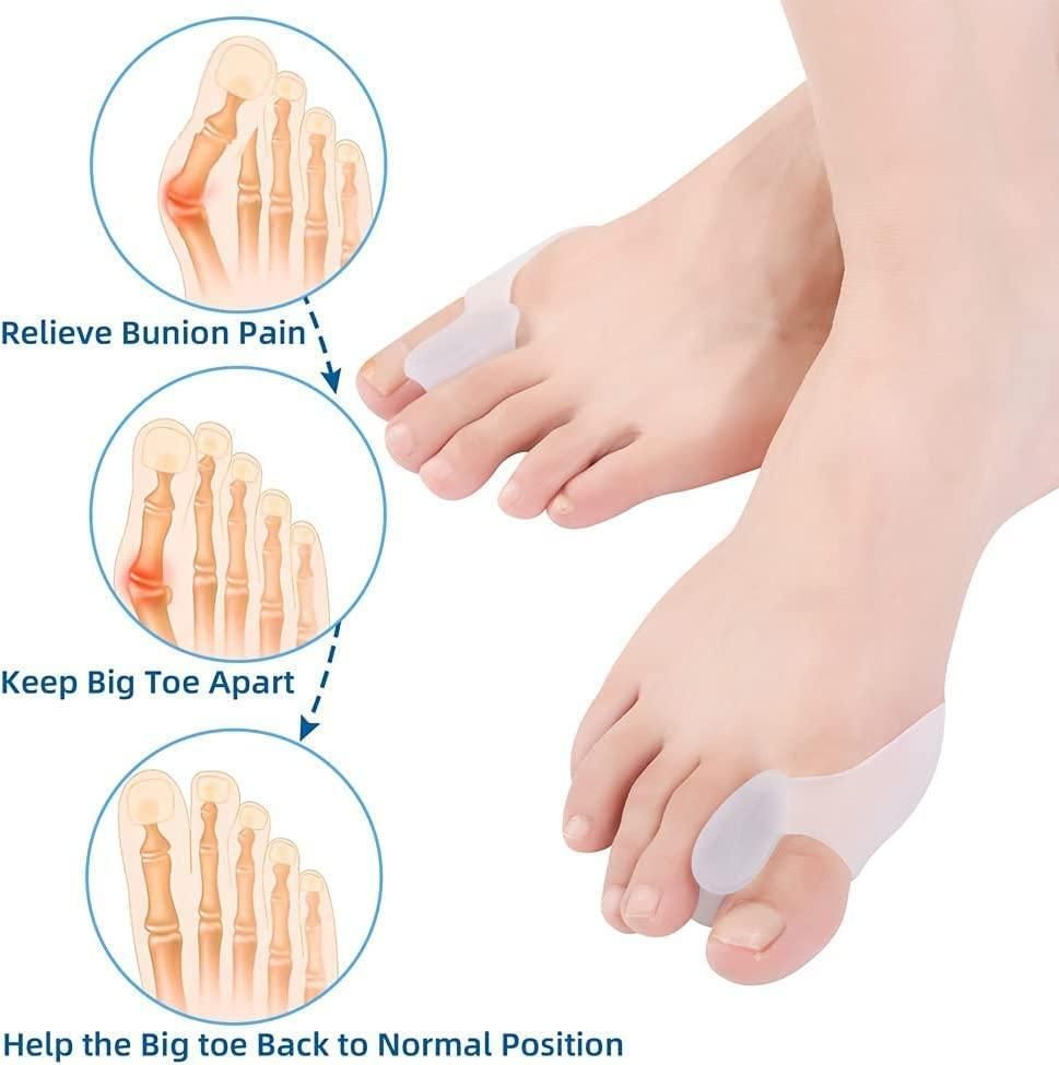 Bunion Corrector Pads with Separator (Pair of 1)